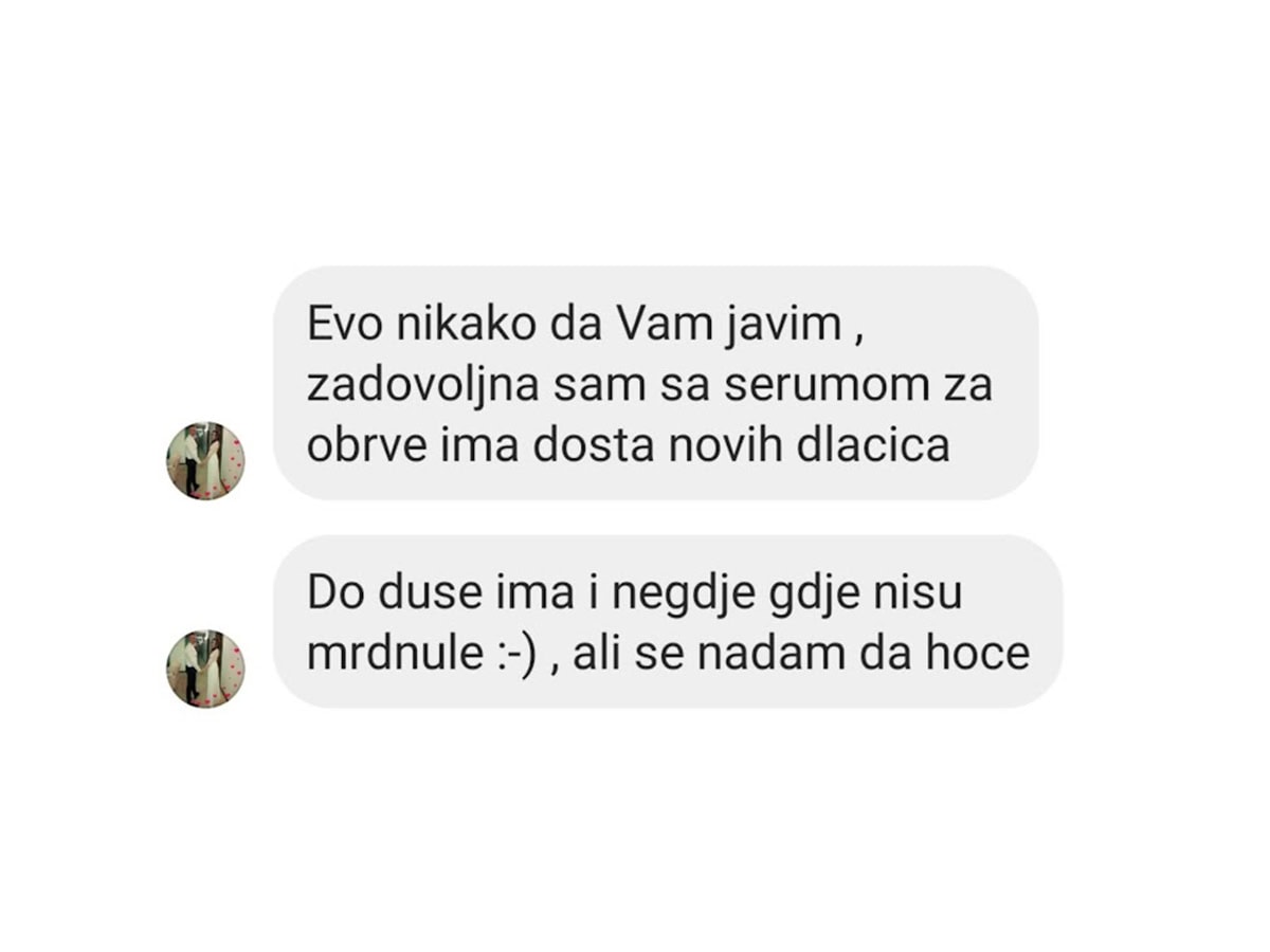 trepolea iskustvo